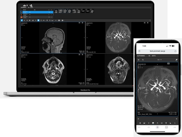 DICOMビューア - MacBookとスマートフォンで脳MRI・MRA画像を表示